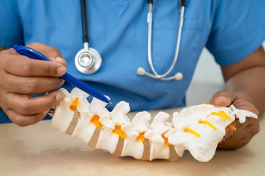 Ortopedi bölümünde tedavi için omurga iskeleti ve sinir modeline sahip bir doktor..