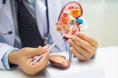 Böbrek hastalığı, Kronik Böbrek Hastalığı, Doktor, hastanede tedavi ve eğitim için insan modeli tutuyor..