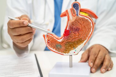 Mide hastalığı, hastanede teşhis ve tedavi için insan anatomisi modeli olan bir doktor..