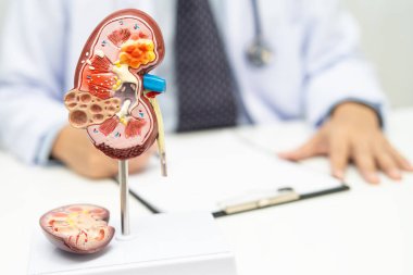 Kronik böbrek hastalığı, Doktor hastanede tedavi ve çalışma için insan modeli tutuyor..