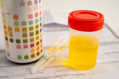 İdrar tahlili, reaksiyonlu idrar kabı. PH kağıt testi ve karşılaştırma tablosu laboratuvarda..