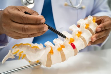 Ortopedi bölümünde tedavi için omurga iskeleti ve sinir modeline sahip bir doktor..