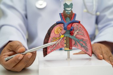 Zatürree, akciğer kanseri, Asyalı doktor hastanede teşhis ve tedavi için insan anatomisi modeli tutuyor.