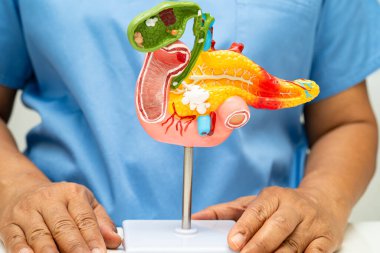 Pankreas iltihabı, pankreas hastası Asyalı doktor, safra kesesi ve safra kesesi insan anatomisi modeli..