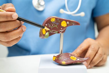 Dünya Hepatit Günü 'nde siroz, karaciğer kanseri, yağlı karaciğer, karaciğer anatomisi olan Asyalı doktor..