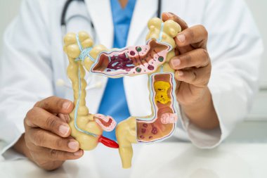 Bağırsak, apandis ve sindirim sistemi, hastanede teşhis ve tedavi için anatomi modelini tutan doktor..