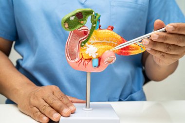Pankreas iltihabı, pankreas hastası Asyalı doktor, safra kesesi ve safra kesesi insan anatomisi modeli..