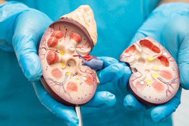 Böbrek hastalığı, Kronik Böbrek Hastalığı, Doktor, hastanede tedavi ve eğitim için insan modeli tutuyor..