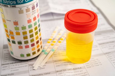 İdrar tahlili, reaksiyonlu idrar kabı. PH kağıt testi ve karşılaştırma tablosu laboratuvarda..