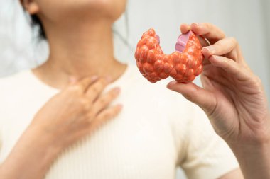Hipertiroidizm, aşırı aktif tiroid, tiroid lenfoma, tiroid bezi insan anatomisi olan Asyalı kadın..
