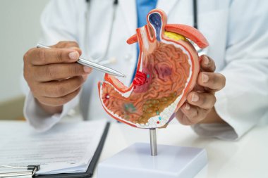 Mide hastalığı, hastanede teşhis ve tedavi için anatomi modeli tutan bir doktor..