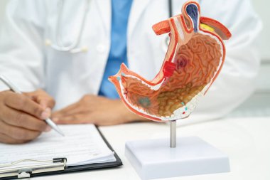 Mide hastalığı, hastanede teşhis ve tedavi için anatomi modeli tutan bir doktor..