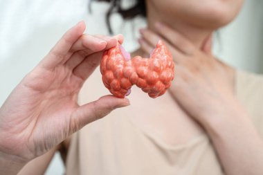 Hipertiroidizm, aşırı aktif tiroid, tiroid lenfoma, tiroid bezi insan anatomisi olan Asyalı kadın..