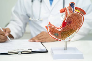 Mide hastalığı, hastanede teşhis ve tedavi için anatomi modeli tutan bir doktor..
