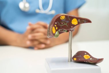 Dünya Hepatit Günü 'nde siroz, karaciğer kanseri, yağlı karaciğer, karaciğer anatomisi olan Asyalı doktor..