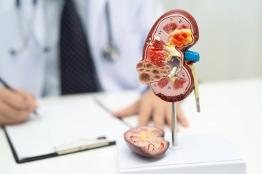 Kronik böbrek hastalığı, Doktor hastanede tedavi ve çalışma için insan modeli tutuyor..