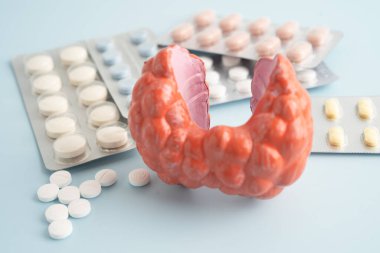 İlaç tedavisi gören tiroid modeli, Hipertiroidizm, Aşırı Aktif veya Lenfoma.