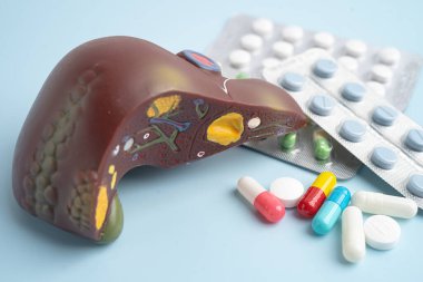 Hap tedavisi gören karaciğer modeli, siroz, karaciğer kanseri, yağlı karaciğer..
