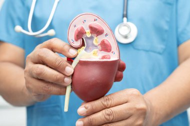 Böbrek hastalığı, kronik böbrek hastalığı, hastanede çalışmak ve tedavi etmek için doktor holding modeli..