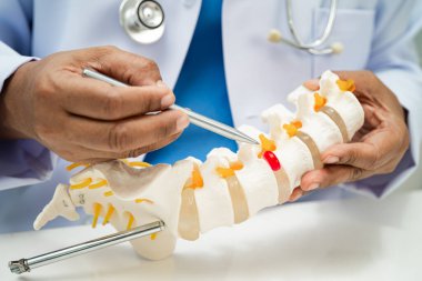 Ortopedi bölümünde tedavi için omurga iskeleti ve sinir modeline sahip bir doktor..