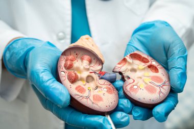 Böbrek hastalığı, Kronik Böbrek Hastalığı, Doktor, hastanede tedavi ve eğitim için insan modeli tutuyor..