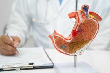 Mide hastalığı, hastanede teşhis ve tedavi için anatomi modeli tutan bir doktor..