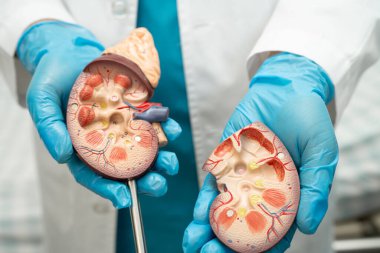 Böbrek hastalığı, Kronik Böbrek Hastalığı, Doktor, hastanede tedavi ve eğitim için insan modeli tutuyor..