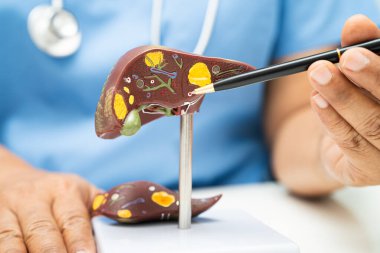 Dünya Hepatit Günü 'nde siroz, karaciğer kanseri, yağlı karaciğer, karaciğer anatomisi olan Asyalı doktor..