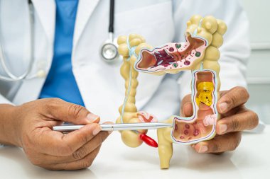 Bağırsak, apandis ve sindirim sistemi, hastanede teşhis ve tedavi için anatomi modelini tutan doktor..