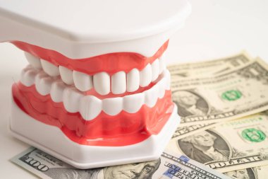 Diş tedavisi masrafları, diş masrafları veya ücretler, diş modelli Avro banknotu parası.