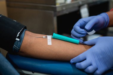 Kan nakli sırasında bir insanın atardamarına iğne bağlayan kauçuk eldivenle elinizi kapatın.