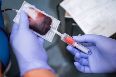 Kan nakli odasında ampullü kan örnekleri alırken elleri lastik eldiven takıyor.