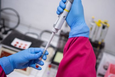 Kauçuk eldivenli eller, laboratuardaki küçük tüplere kan çekerken pipetleri kullanıyorlar.