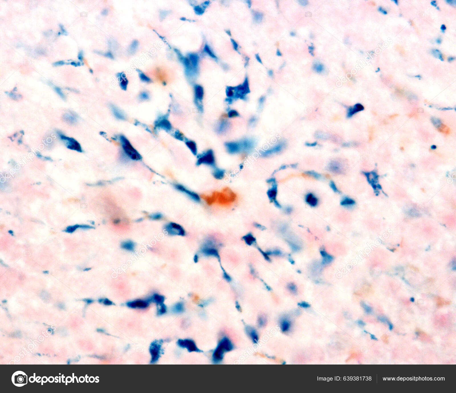 Kupffer Cells Macrophages Liver Colloidal Iron Acts Vital Stain Can — Foto  © jlcalvo@ucm.es #639381738, image size:1600x1380