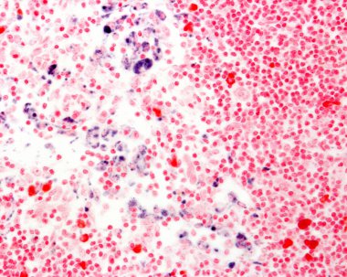 Trypan blue is a vital stain that can be introduced in the body. Circulating Trypan blue is phagocyted by macrophages which become marked in blue. Light microscope micrograph showing macrophages in the medullary sinuses of a lymph node. Mast cells ap