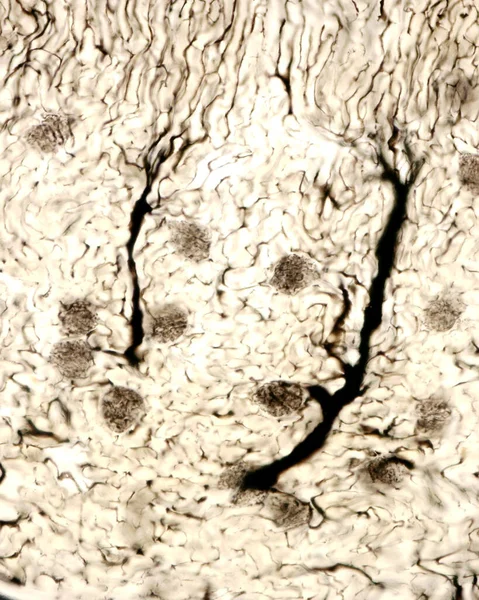 The study of an organ microvasculature usually implies the filling of blood vessels with a label visible under the microscope. Light microscope micrograph of the blood vessels in the kidney cortex of an experimental animal perfused with Indian ink. L