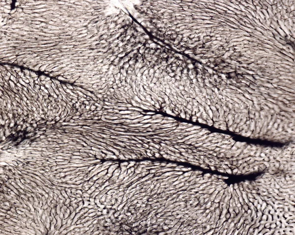 The study of an organ microvasculature usually implies the filling of blood vessels with a label visible under the microscope. Light micrograph of liver blood vessels of an experimental animal labelled with Indian ink showing several central veins of