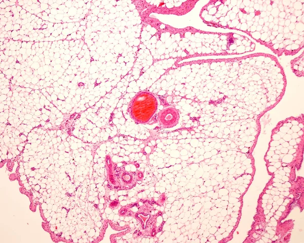 Very low magnification light microscope micrograph of white adipose tissue or fat, stained with hematoxylin and eosin. Adipocytes (fat cells) contain a large lipid droplet. They form lobules surrounded by connective tissue septa with blood vessels.