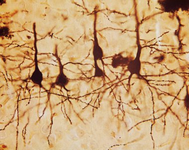 Serebral korteksin piramit nöronları Golgi gümüş kromatlarıyla lekelenmiş. Konik şekilli somadan, büyük apik dendrit ve çoklu bazal dendritten kaynaklanır..