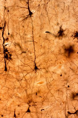 Işık mikroskobu mikroskobu, Golgi gümüş kromatı ile boyanmış serebral korteksin piramit nöronunu gösteriyor. Konik şekilli somadan, büyük apik dendrit ve çoklu bazal dendritten kaynaklanır..