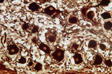 Cajal gümüş nitratla boyanmış otonom sempatik ganglion mikrografı çok kutuplu nöron hücreleri ve sinir liflerinin bir karışımını gösteriyor..