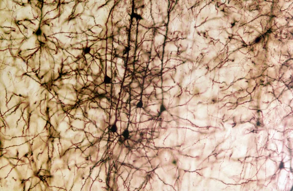 Neuronas Piramidales Corteza Cerebral Manchadas Con Cromato Plata Golgi Partir —  Fotos de Stock