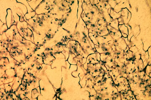 小脑颗粒细胞 小脑颗粒层被高尔基体银染色质染色 显示颗粒细胞丰富 它们有一个非常小的圆形体细胞瘤 有三至五个树突 最后形成一个称为树突的肿块 — 图库照片