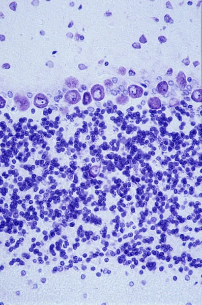小脑皮质从上到下显现出来 分子层 Purkinje细胞层和颗粒层 在颗粒层可以看到高尔基体细胞 Cresyl Violet Stain — 图库照片