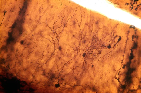 Světelný Mikrograf Hvězdných Buněk Molekulární Vrstvy Mozkové Kůry Obarvené Golgiho — Stock fotografie
