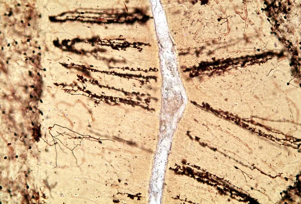 Cortex Cérébral Micrographie Photonique Cortex Cérébelleux Montrant Glie Bergmann Cellules — Photo