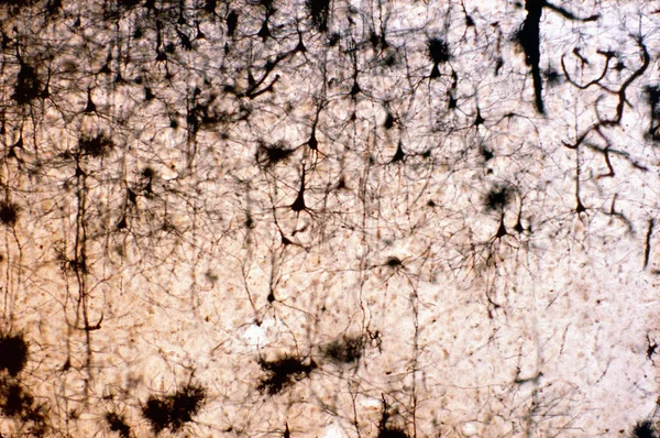 Pyramidové Neurony Mozkové Kůry Obarvené Golgiho Stříbrným Chromátem Kónického Tvaru — Stock fotografie