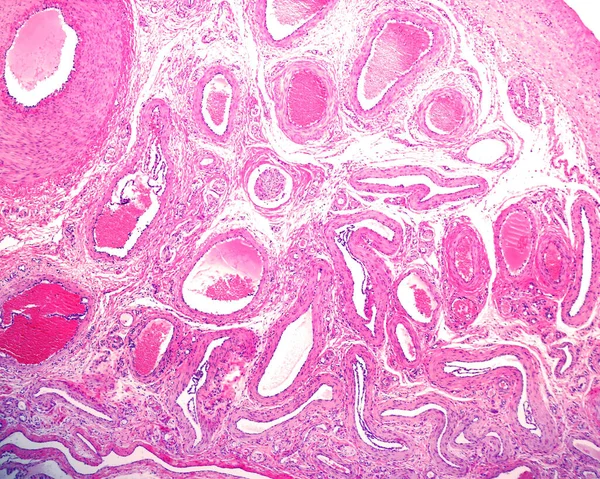翼状丛 Pampiniform Plexus 是由睾丸后部多个睾丸静脉联合而形成的许多小静脉的复合体 它位于雄性精索中 除了来自睾丸的静脉回流外 这种神经丛还有一种诱惑 — 图库照片