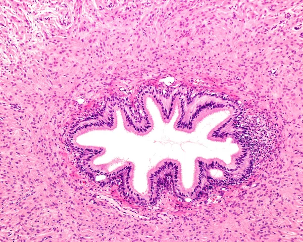 Light microscope micrograph showing a cross-sectioned vas deferens. The star shaped lumen is lined by a pseudostratified columnar epithelium. Outside the mucosa layer, there are fascicles of smooth muscle fibers.