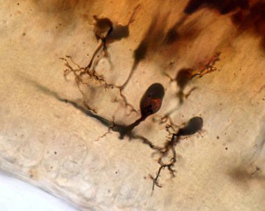 Golgi metodu ile lekelenmiş bir retinanın yüksek büyütme ışık mikroskobu iç pleksi tabakasında sona eren dendritli hücreleri gösteriyor..